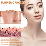 Whitening Soap Supplier - Custom Turmeric Facial Soap