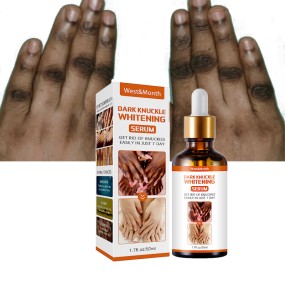 美白精华生产厂家-代工关节暗沉精华