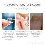 Nail Treatment Pen Factory - OEM Anti Fungal Nail Care Pen