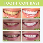 Teeth Whitening Strips Supplier - Coconut Oil Bleaching Strips
