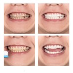 Teeth Whitening Mousse Supplier - Salon 50ml Tooth White