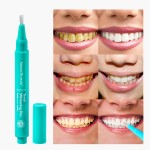 Teeth Whitening Gel Supplier - Dental Bleaching Pen Wholesale