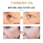 Face Oil Manufacturer - Vitamin C Turmeric Anti Aging 30ml