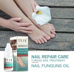 Nail Care Oil Supplier - Onychomucosis Paronychia Treatment