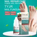 Nail Care Oil Supplier - Onychomucosis Paronychia Treatment