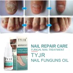 Nail Care Oil Supplier - Onychomucosis Paronychia Treatment