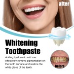Toothpaste Manufacturer - Hyaluronic Acid Whitening 100ml