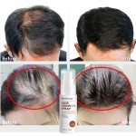 Hair Growth Serum Supplier - Ginseng Anti Hair Loss 30ml