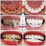 Teeth Whitening Gel Supplier - Effective Plaque Removal Whitening