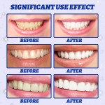Teeth Whitening Strips Manufacturer - Wholesale 5D Stain Removal