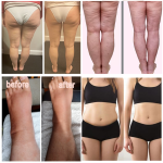 Pressotherapy Machine Supplier - 2in1 Infrared Weight Loss