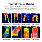 Magnetotherapy Machine Factory - Clinic Body Care Equipment