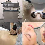 Diathermy Machine Manufacturer - 448khz RF Physiotherapy