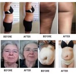 Red Light Therapy Machine Manufacturer - 5D Lipo Laser Belt