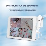 Skin Analyzer Machine Manufacturer - HD Scalp Detection