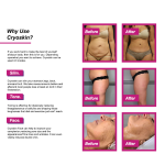 Cryotherapy Machine Factory - Hot Cold Cryo 4.0 Device