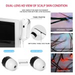 Skin Analyzer Machine Manufacturer - HD Scalp Detection