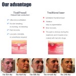 Fractional Therapy Machine Supplier - Heat Based Skin Treatment