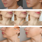 Face Massager Supplier - RF EMS Microcurrent Lift