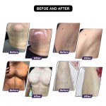 Diode Laser Machine Supplier - 3 Waves Fiber 808