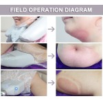 Body Beauty Machine Manufacturer - 2 Handle Diamond Ice