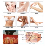 Laser Hair Removal Manufacturer - Alexan Ice Platinum