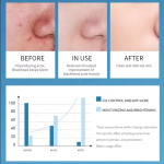 Men's Face Wash Supplier - Soap-free Oil Control Gentle