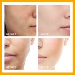 Vitamin C Serum Supplier - Custom Logo Whitening Moisturizing