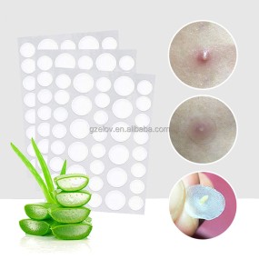痘痘贴生产厂家-天然植物萃取防水