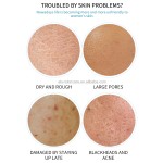 Hyaluronic Acid Mask Supplier - Natural Extract Pore Shrinking