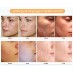 Dead Sea Mud Factory - Aloe Deep Pore Cleansing