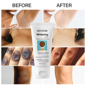 Whitening Cream Supplier - Vitamin E Full Body Knees Elbows Underarm