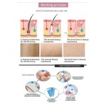 Laser Machine Factory - Portable Q-Switch Nd Yag Tattoo Removal