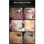 Pico Laser Factory - 1064nm/532nm/755NM/1320NM Second Machine