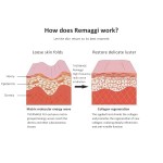 Face Lifting Machine Supplier - 2024 New Hot Sale RF Fractional