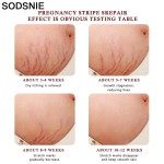 Stretchmark Cream Supplier - Non-Alcoholic Fragrance Free Lactation