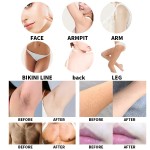 Laser Machine Factory - Portable Q-Switch Nd Yag Tattoo Removal