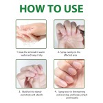 Nail Fungus Spray Factory - Private Label 2025 New 7 Days Damage Repair Cuticle Care