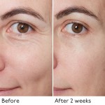 Eye Patches Supplier - 24K Anti-Aging Retinol Rose Crystal Sheet Brightening