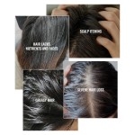 Shampoo Manufacturer - 500ml Vegan Tea Tree Scalp Relief Dandruff Prevention Hair