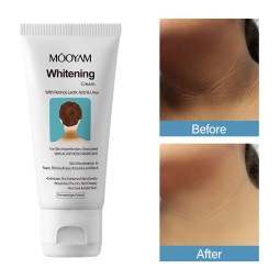 Whitening Cream Factory - Organic for Acanthosis Nigricans Glycerin Niacinamide Based