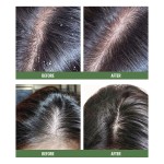 Shampoo Manufacturer - 500ml Vegan Tea Tree Scalp Relief Dandruff Prevention Hair