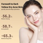 Anti-Aging Serum Factory - Turmeric Face Whitening Brightening Freckles Dark Spots