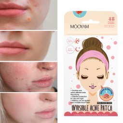Pimple Patches Supplier - Custom Hydrocolloid Night Covering Zits Acne Invisible