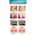 Tattoo Removal Machine Factory - 532nm 1064nm Tattoo Removal Pigmentations Beauty Equipment