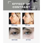 CO2 Laser Machine Manufacturer - Shandong Huamei New Wrinkle Removal Scar Removal Tighten Vagina