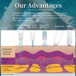 HIFU Machine Manufacturer - Professional Facial Neck Tightening New Anti-Wrinkle 7d Vaginal Tighten