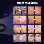 Diamond Peeling Machine Supplier - New Arrival Crystal Diamond Peeling Dermabrasion Microdermabrasion