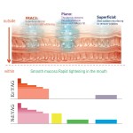 Erbium Laser Factory - 2940nm 4D Pro Vaginal Rejuvenation Tightening Scar Removal 1064nm