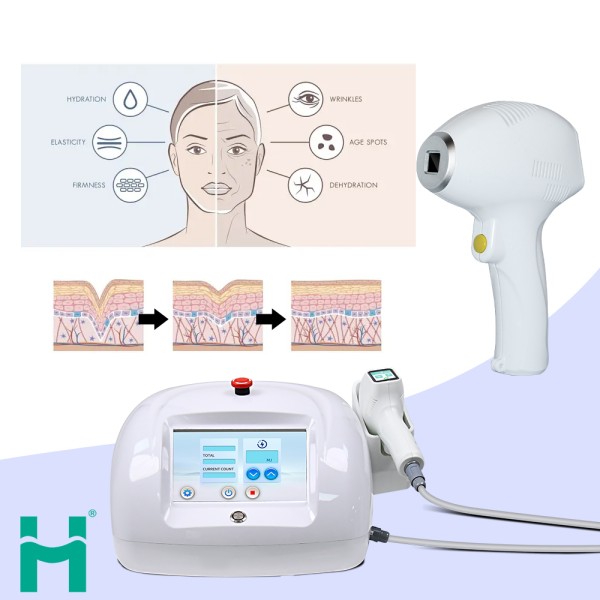 Facial Lifting Device Supplier - Small Laser Wrinkle Remover Facial Laser Lifting Machine